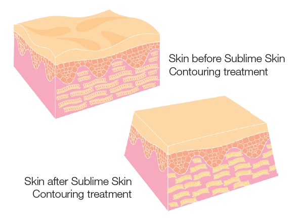 How Sublime™ Works